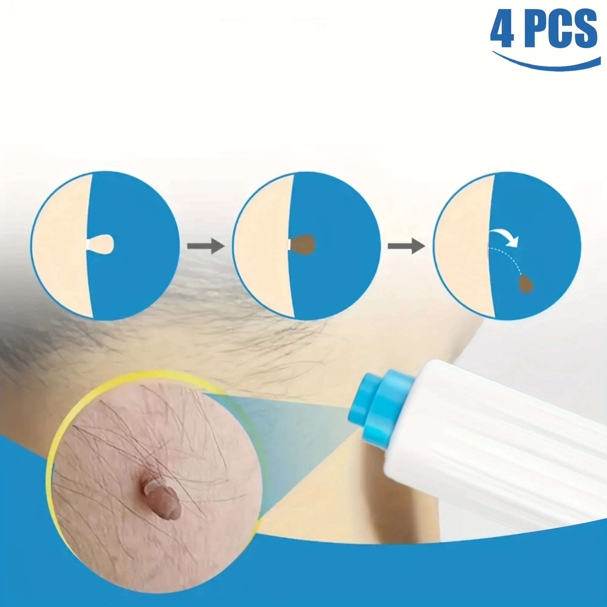 1/2/4 Pcs Removal Kit for Skin Care, One Hand User Friendly Design, Safe and Effective for Home Use