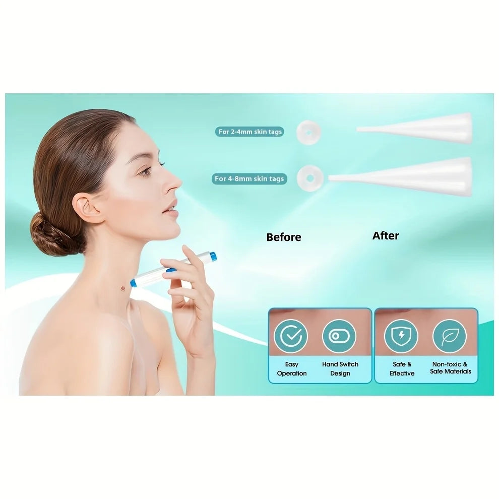 1/2/4 Pcs Removal Kit for Skin Care, One Hand User Friendly Design, Safe and Effective for Home Use