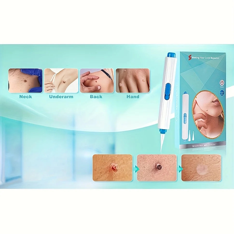 1/2/4 Pcs Removal Kit for Skin Care, One Hand User Friendly Design, Safe and Effective for Home Use